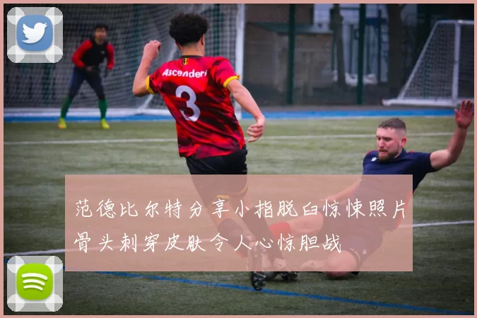 范德比尔特分享小指脱臼惊悚照片骨头刺穿皮肤令人心惊胆战